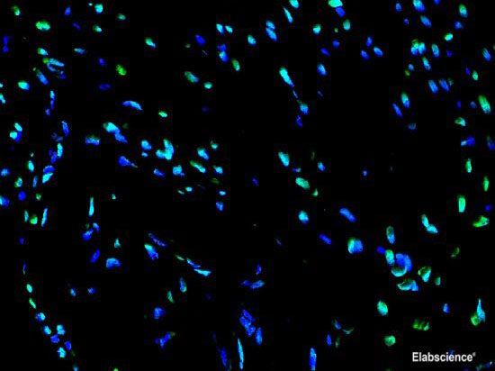 One-step TUNEL In Situ Apoptosis Kit (Green, FITC)